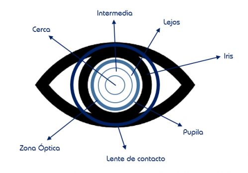 Geometría Lentes de contacto progresiva