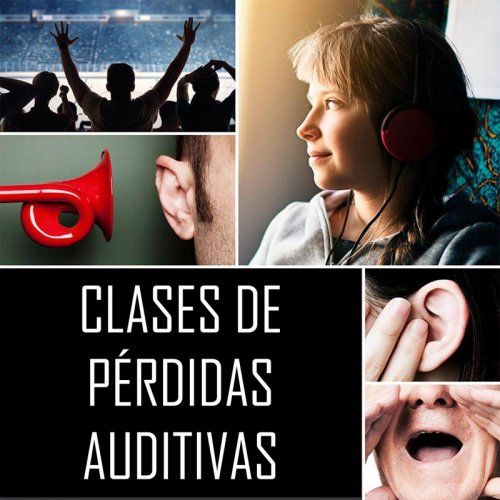 Pérdidas Auditivas